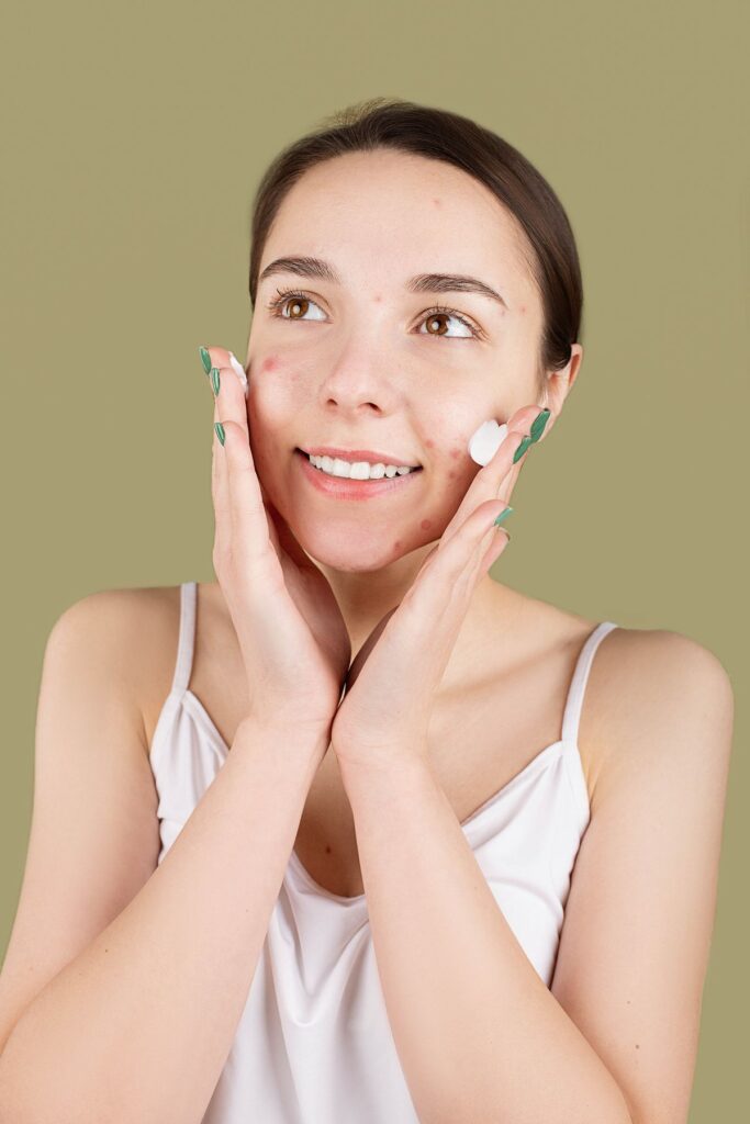 Hình ảnh minh họa: Mụn đầu đen có tự hết không? - SkinLab by Dr. Thục