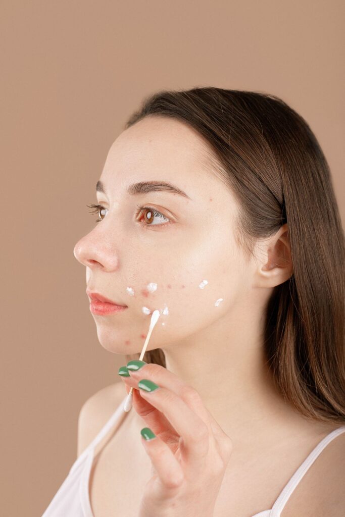 Hình ảnh minh họa: Chế độ ăn giúp giảm mụn - SkinLab by Dr. Thục
