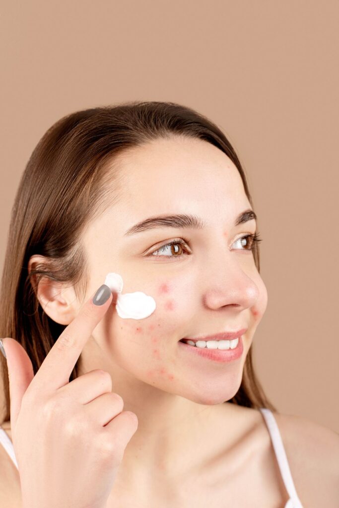 Hình ảnh minh họa: Stress có gây mụn không? - SkinLab by Dr. Thục
