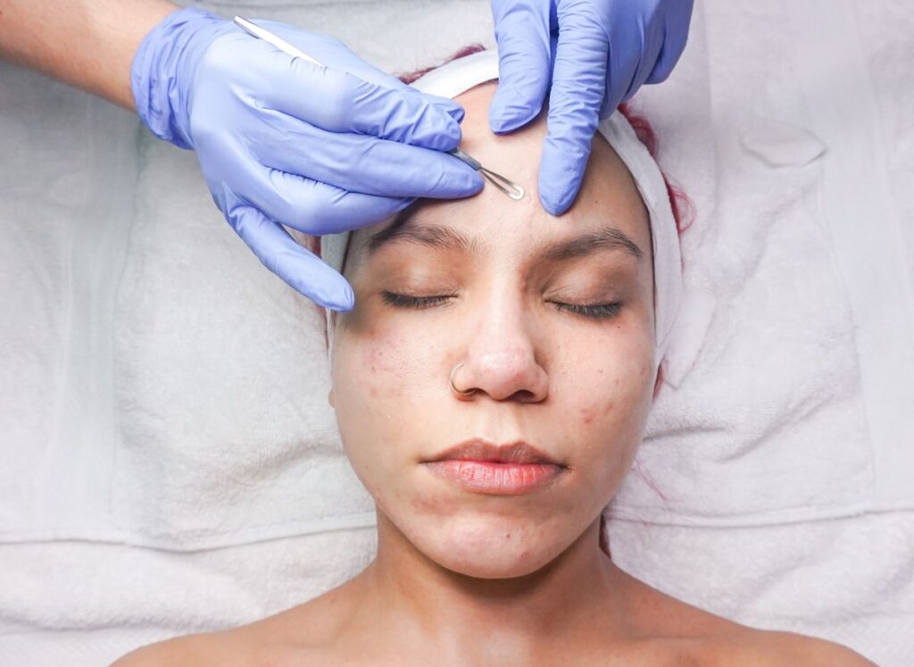 Hình ảnh minh họa: Mụn do mỹ phẩm - SkinLab by Dr. Thục