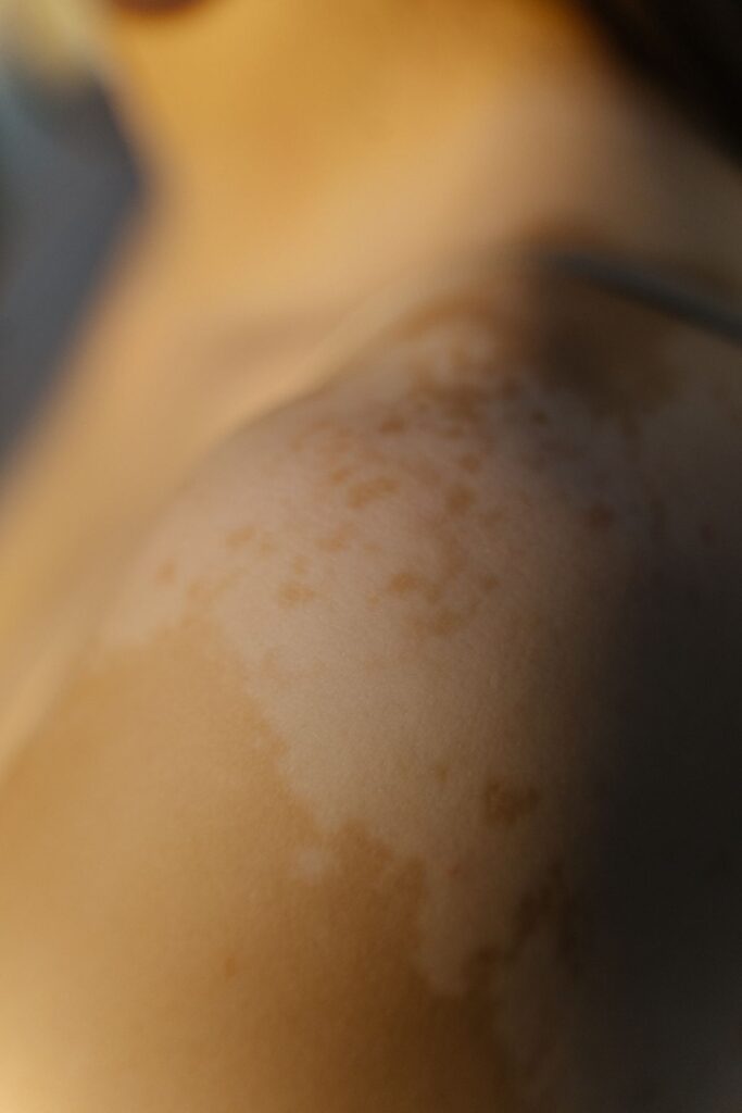 Hình ảnh minh họa: Thuốc trị nám - SkinLab by Dr. Thục