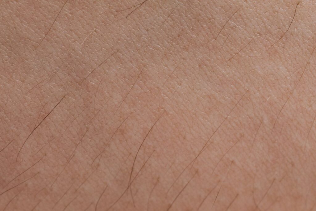 Hình ảnh minh họa: Dị ứng mỹ phẩm - SkinLab by Dr. Thục