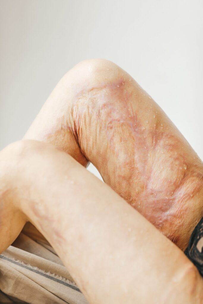 Hình ảnh minh họa: Nấm da - SkinLab by Dr. Thục