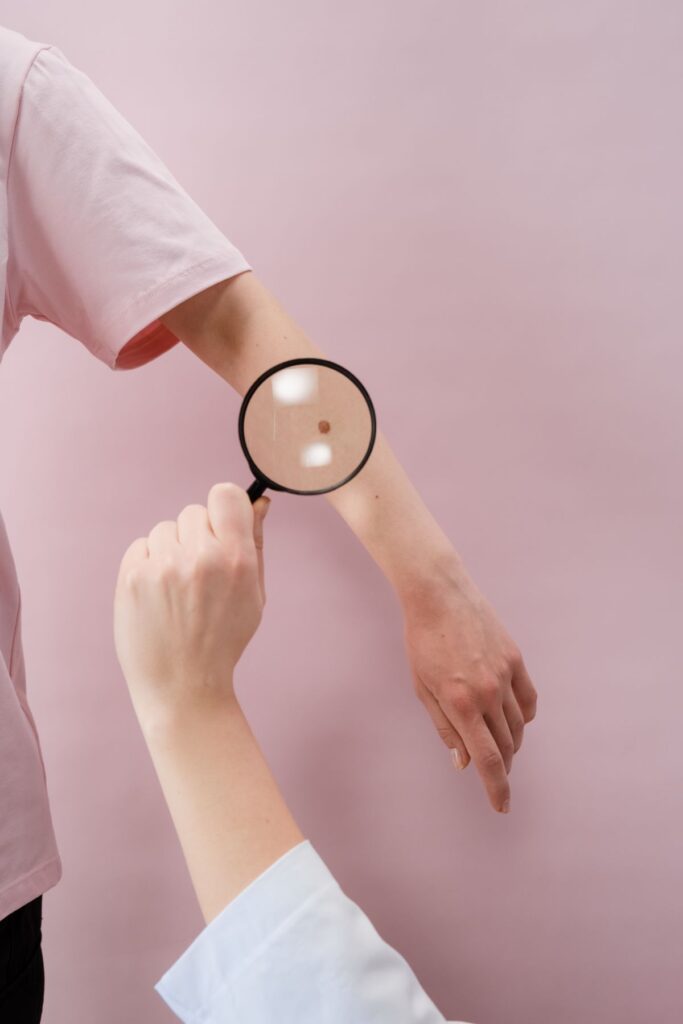 Hình ảnh minh họa: Lang ben - SkinLab by Dr. Thục